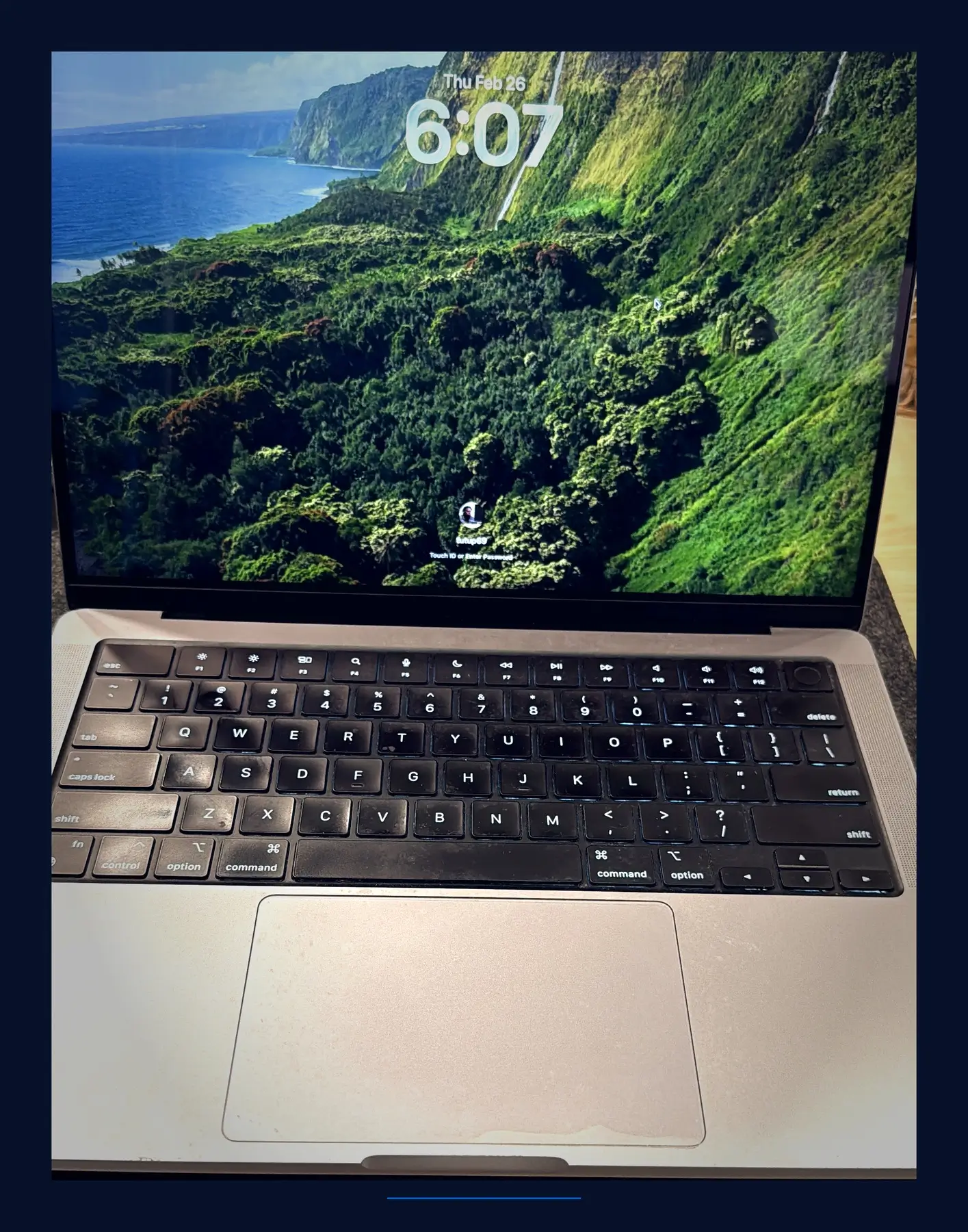MacBook screen replacement Malaysia — KissMyMac Apple-certified technician repairing a MacBook display